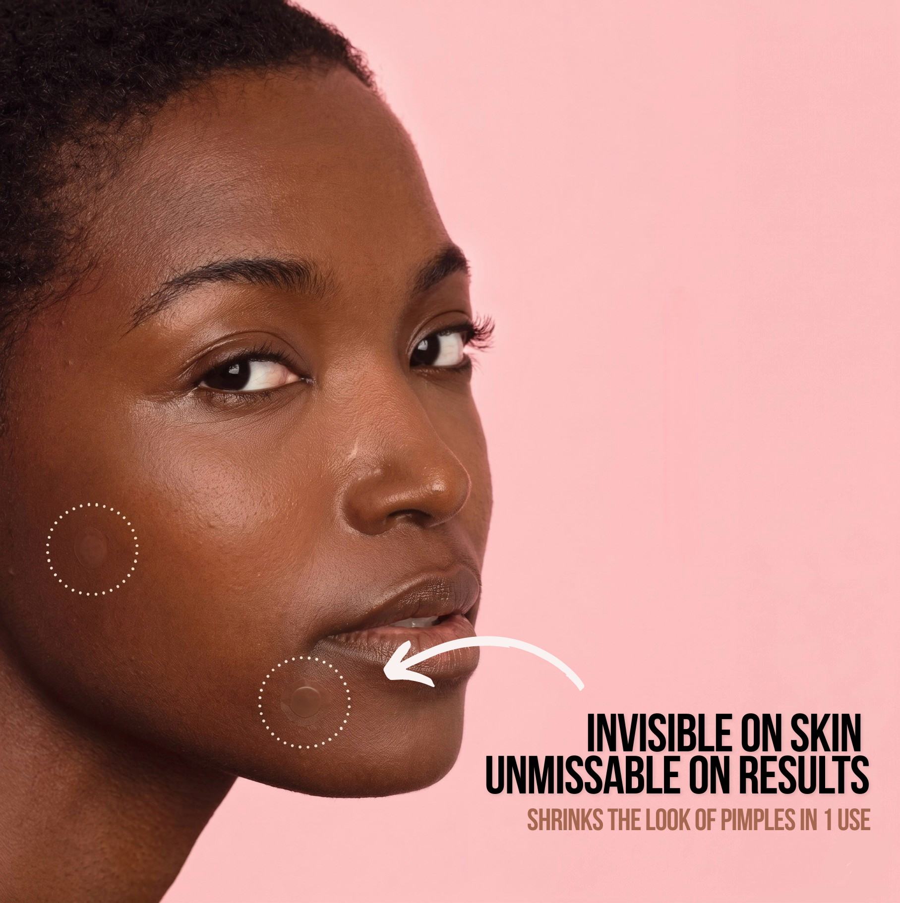 Woman's face with pimple marks on a pink background, text indicating product effectiveness.